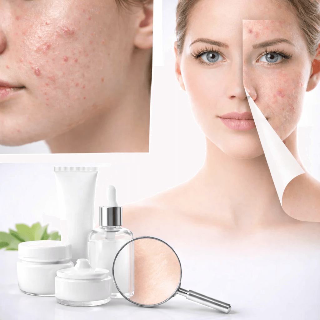 Skin Diseases